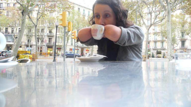 Una noia que té una malformació a les mans prenent-se una tassa de cafè