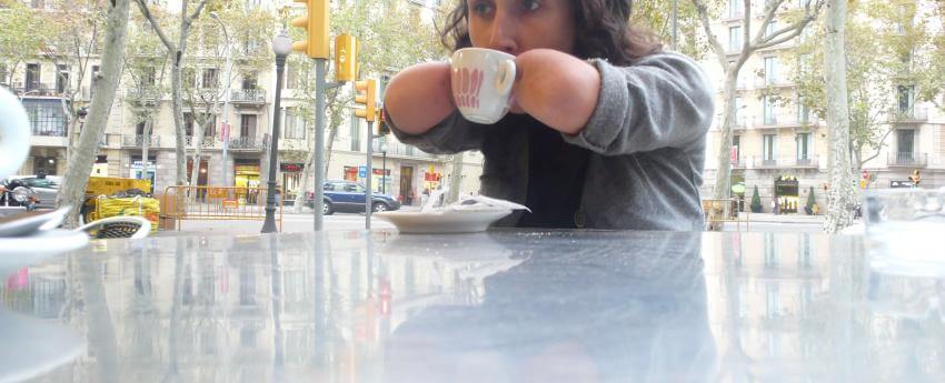 Una noia que té una malformació a les mans prenent-se una tassa de cafè